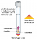 Ultrafiltration